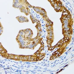 Anti-CHAF1B antibody used in IHC (Paraffin sections) (IHC-P). GTX65808