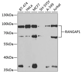 Anti-RanGAP1 antibody used in Western Blot (WB). GTX65813
