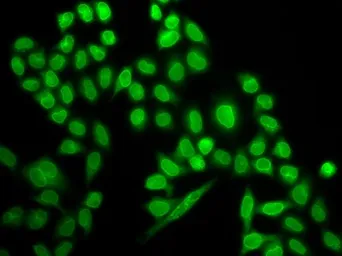 Anti-RanGAP1 antibody used in Immunocytochemistry/ Immunofluorescence (ICC/IF). GTX65813