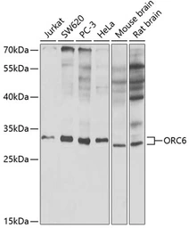 Anti-ORC6 antibody used in Western Blot (WB). GTX65816