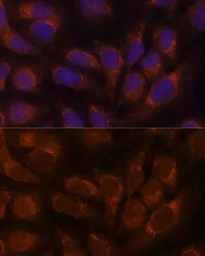 Anti-LZIP antibody used in Immunocytochemistry/ Immunofluorescence (ICC/IF). GTX65817