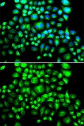 Anti-BCAP31 antibody used in Immunocytochemistry/ Immunofluorescence (ICC/IF). GTX65823