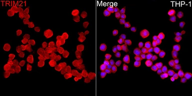 Anti-SSA1 antibody used in Immunocytochemistry/ Immunofluorescence (ICC/IF). GTX65834