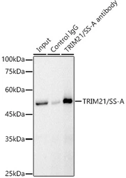 Anti-SSA1 antibody used in Immunoprecipitation (IP). GTX65834