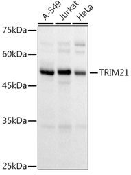 Anti-SSA1 antibody used in Western Blot (WB). GTX65834