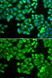 Anti-PPP4C antibody used in Immunocytochemistry/ Immunofluorescence (ICC/IF). GTX65836