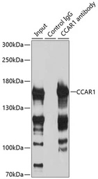 Anti-CCAR1 antibody used in Immunoprecipitation (IP). GTX65837