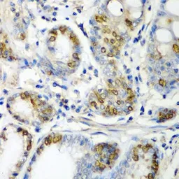 Anti-alpha A Crystallin antibody used in IHC (Paraffin sections) (IHC-P). GTX65843