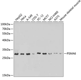 Anti-PSMA6 antibody used in Western Blot (WB). GTX65847