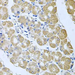Anti-STRN3 antibody used in IHC (Paraffin sections) (IHC-P). GTX65851