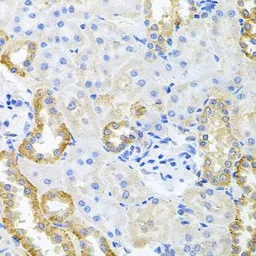 Anti-STRN3 antibody used in IHC (Paraffin sections) (IHC-P). GTX65851