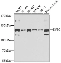 Anti-EIF3S8 antibody used in Western Blot (WB). GTX65854