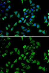 Anti-EIF3S8 antibody used in Immunocytochemistry/ Immunofluorescence (ICC/IF). GTX65854