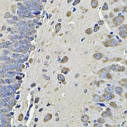 Anti-EIF3S8 antibody used in IHC (Paraffin sections) (IHC-P). GTX65854