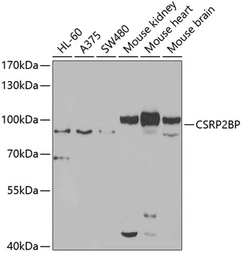 Anti-CSRP2BP antibody used in Western Blot (WB). GTX65856