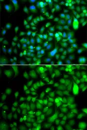 Anti-CSRP2BP antibody used in Immunocytochemistry/ Immunofluorescence (ICC/IF). GTX65856