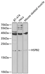 Anti-HSPB2 antibody used in Western Blot (WB). GTX65869