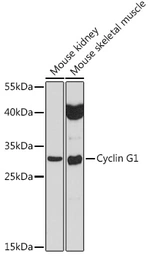 Anti-Cyclin G1 antibody used in Western Blot (WB). GTX65870