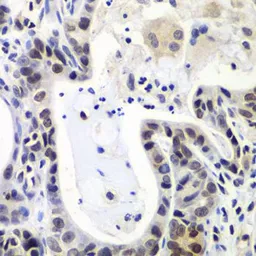 Anti-LSM2 antibody used in IHC (Paraffin sections) (IHC-P). GTX65872