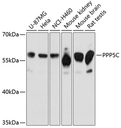 Anti-PPP5C antibody used in Western Blot (WB). GTX65877