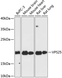Anti-VPS25 antibody used in Western Blot (WB). GTX65881