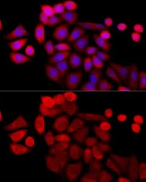 Anti-LRDD antibody used in Immunocytochemistry/ Immunofluorescence (ICC/IF). GTX65888