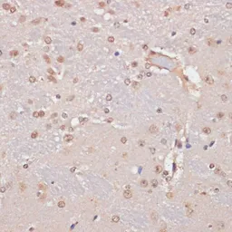 Anti-LRDD antibody used in IHC (Paraffin sections) (IHC-P). GTX65888