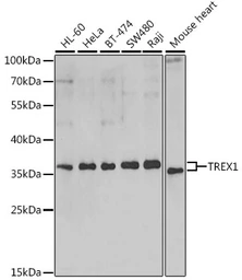 Anti-TREX1 antibody used in Western Blot (WB). GTX65894
