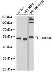 Anti-Hice1 antibody used in Western Blot (WB). GTX65898