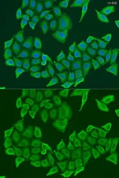 Anti-Hice1 antibody used in Immunocytochemistry/ Immunofluorescence (ICC/IF). GTX65898