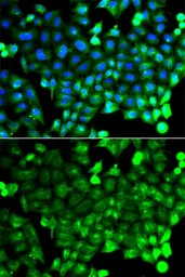 Anti-NCALD antibody used in Immunocytochemistry/ Immunofluorescence (ICC/IF). GTX65899