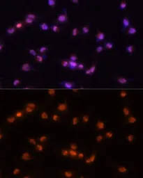 Anti-PRP8 antibody used in Immunocytochemistry/ Immunofluorescence (ICC/IF). GTX65909