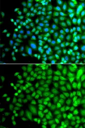 Anti-FAM48A antibody used in Immunocytochemistry/ Immunofluorescence (ICC/IF). GTX65918