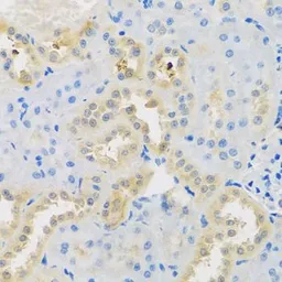 Anti-DNAL1 antibody used in IHC (Paraffin sections) (IHC-P). GTX65922