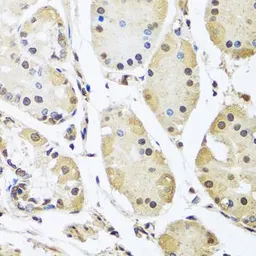 Anti-hnRNP L antibody used in IHC (Paraffin sections) (IHC-P). GTX65923