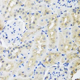 Anti-hnRNP L antibody used in IHC (Paraffin sections) (IHC-P). GTX65923