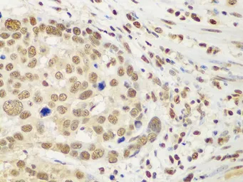 Anti-HDAC2 antibody used in IHC (Paraffin sections) (IHC-P). GTX65924
