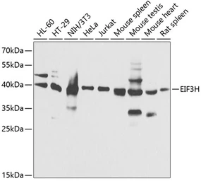 Anti-eIF3H / EIF3S3 antibody used in Western Blot (WB). GTX65925