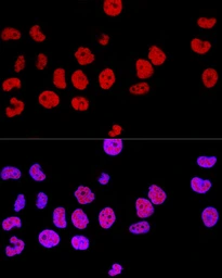 Anti-CTCF antibody used in Immunocytochemistry/ Immunofluorescence (ICC/IF). GTX65926