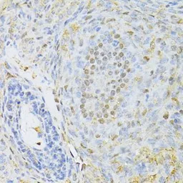 Anti-CTCF antibody used in IHC (Paraffin sections) (IHC-P). GTX65930