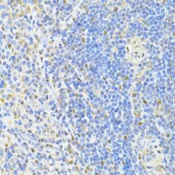 Anti-CTCF antibody used in IHC (Paraffin sections) (IHC-P). GTX65930