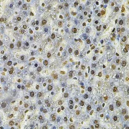 Anti-IFI16 antibody used in IHC (Paraffin sections) (IHC-P). GTX65937