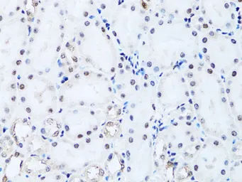 Anti-HIST2H2BE antibody used in IHC (Paraffin sections) (IHC-P). GTX65940