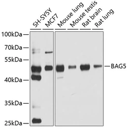 Anti-BAG5 antibody used in Western Blot (WB). GTX65944