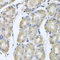 Anti-BAG5 antibody used in IHC (Paraffin sections) (IHC-P). GTX65944