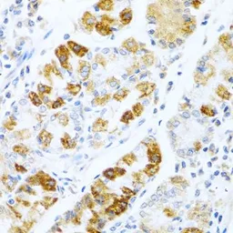 Anti-BMP3 antibody used in IHC (Paraffin sections) (IHC-P). GTX65951