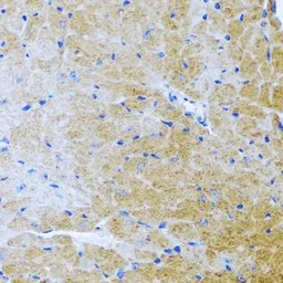 Anti-BMP3 antibody used in IHC (Paraffin sections) (IHC-P). GTX65951