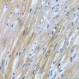 Anti-BMP3 antibody used in IHC (Paraffin sections) (IHC-P). GTX65951