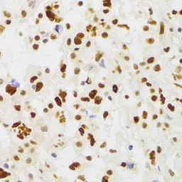 Anti-NASP antibody used in IHC (Paraffin sections) (IHC-P). GTX65952