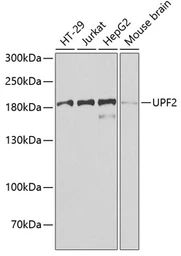 Anti-Rent2 antibody used in Western Blot (WB). GTX65954